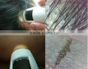 2012 personal beauty equipment facial care skin scope analysis