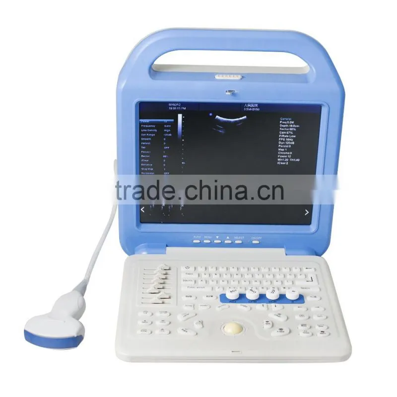 Portable Full Digital Color Doppler Ultrasound Scanner Diagnostic System 2 Probe with convex probe and transvaginal probe