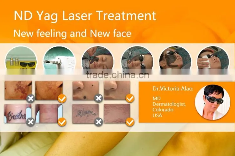 2015 Laser Hair removal / nd yag laser hair removal machine ( FDA )