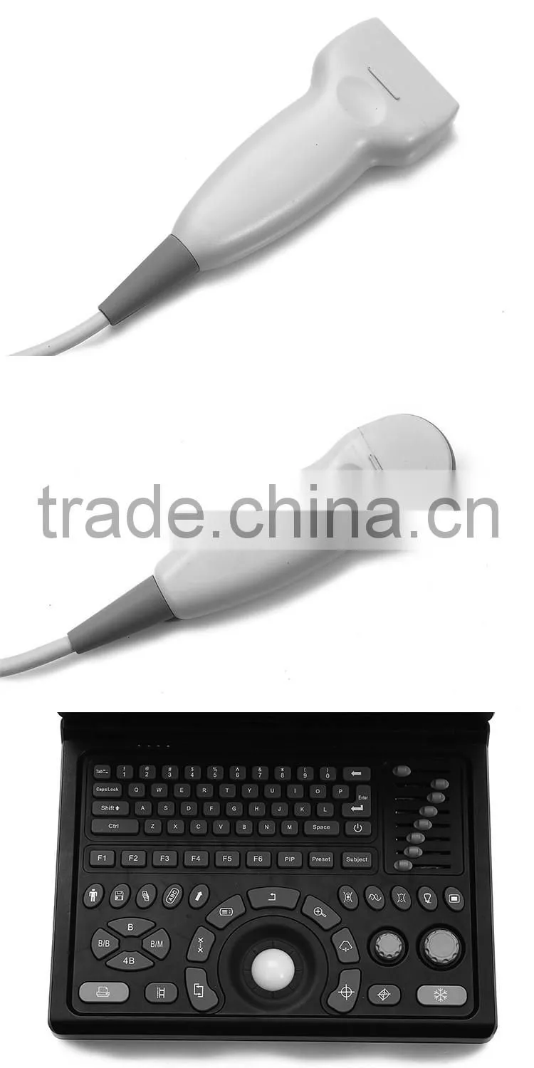 3D laptop veterinary ultraaouns machine with low price