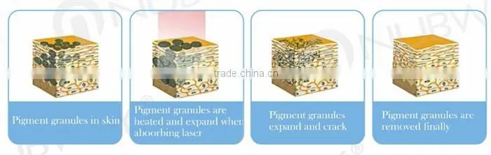 Q switched nd yag and ruby laser