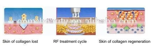 High technology Fractional rf radio frequency machine for face and body face lifting -F-TJ03