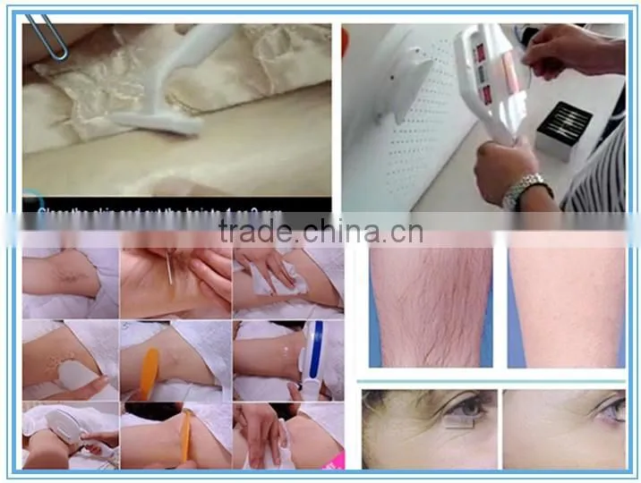 medical ce approved permanent Hair Remove device SHR hair removal IPL