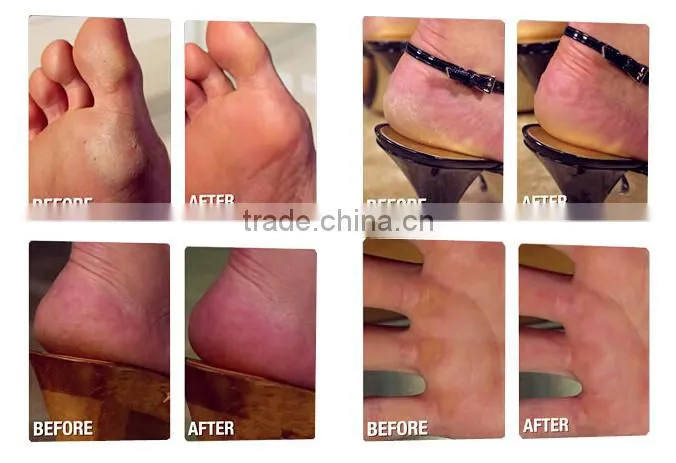 Detacheable Head Design Battery Operated foot buffer /Pedicure machine/foot file in Summer solution