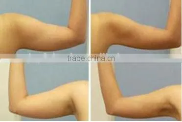 Guangzhou beauty equipment fat cavitation slimming machine