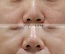 M-L02 most popular LED Light Treatment Facial Skin Care Red Green Blue Light for skin rejuvenation