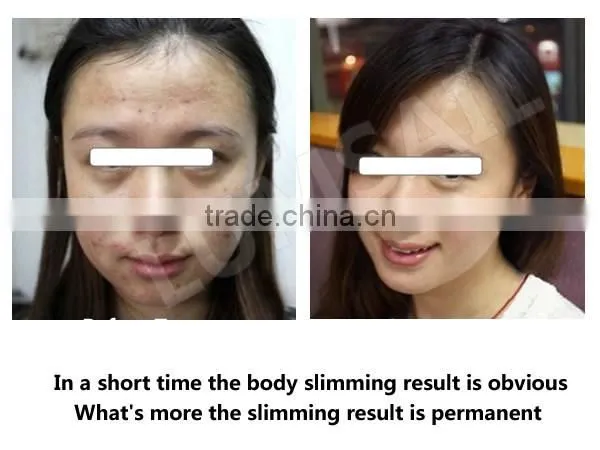 LED Phototherapy Lamp/Beauty Salon Infrared Lamp/Facial skin acne/skin tightening/skin rejuvenation/hair loss treatments