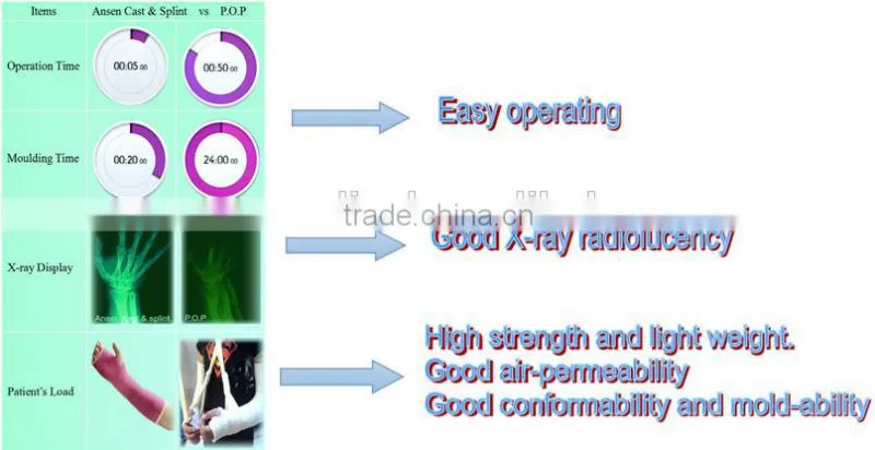 Hot Selling Moisture Resistant Medical Consumbles Orthopedic Fiberglass and Polyester Casting Tape