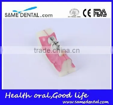Right Tooth Tissue Decomposition Model Dental Eduction Assitant No. DEA-17