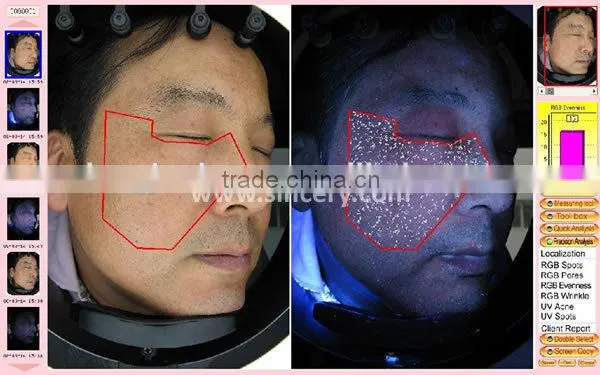 Portable UV Light Facial Skin Analysis Machine Skin Scanner