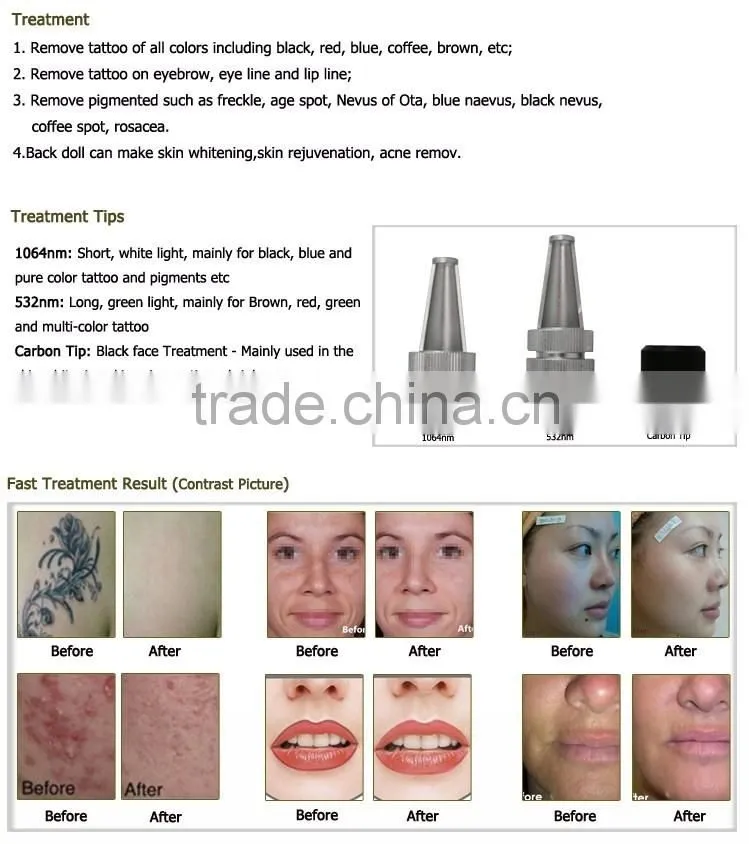 home laser tattoo removal