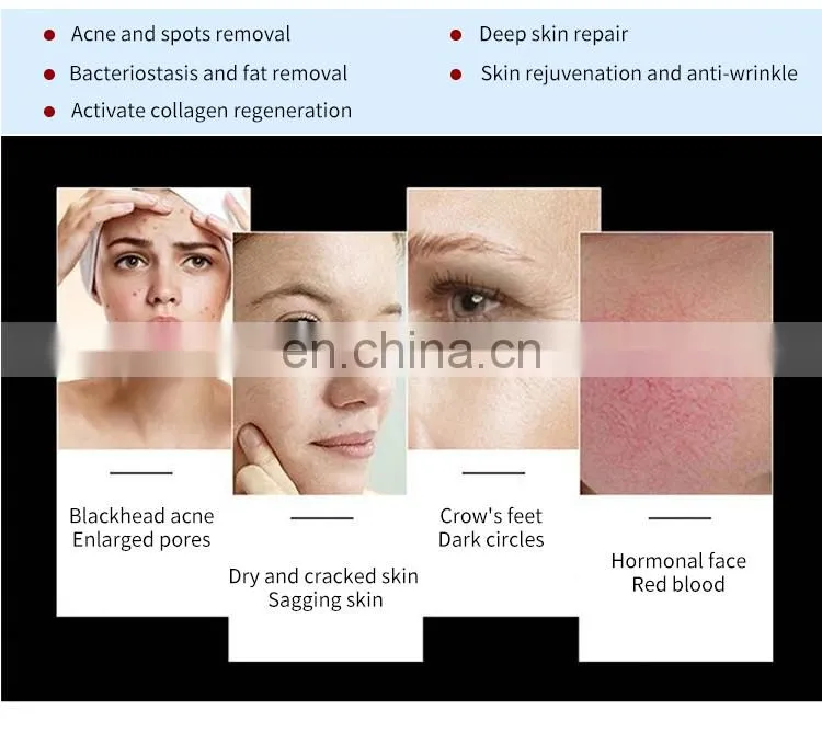 LED Light 7 Color Facial SPA Nano Photon Skin Rejuvenation Device PDT Therapy Hot Cold Spray Skin Care Beauty Instrument