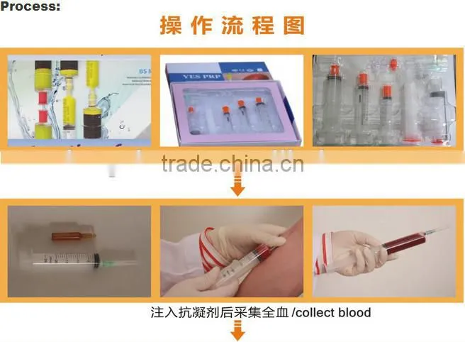 Prp Centrifuge Machine Price for TD4-ZF