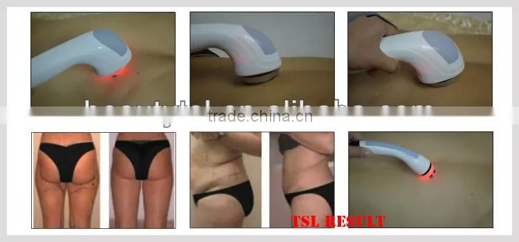 Real 5mhz rf cavitation skin care machine with 40khz cavitation and 5mhz rf handles