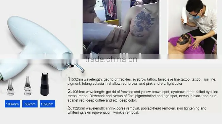 Economy laser epilation system for permanent