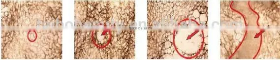 high tech rf cavitation body slimming machine/laser cavitation rf vacuum cavitation slimming/fat removal focused ultrasonic