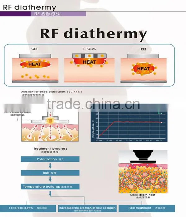 Keywords latest rf beauty equipment