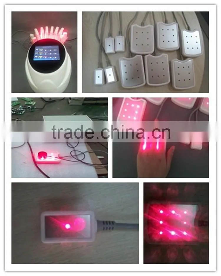 vacuum roller 650nm lipo laser liposuction fat reduction machine without surgery