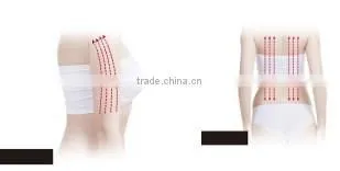 Best rf skin tightening face lifting machine