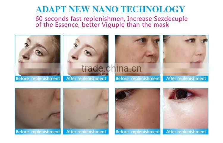 new china products for sale home use facial massage machine ultrasonic beauty machine