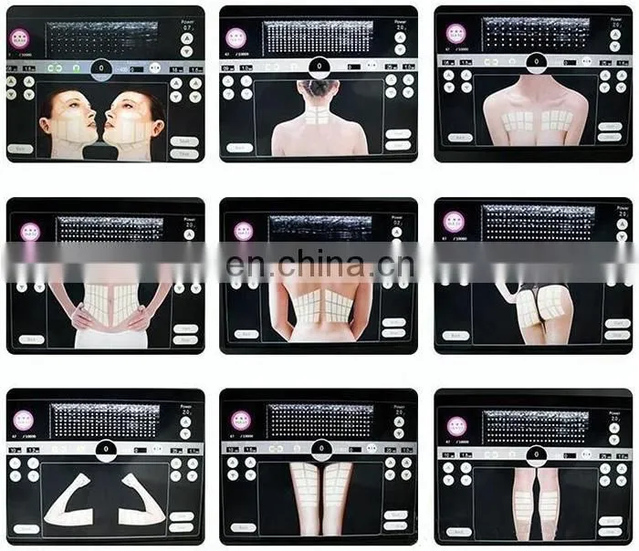 Portable Ultrasonic 3D Anti-aging High Intensity Slimming Machine Face Lifting Wrinkle Removal
