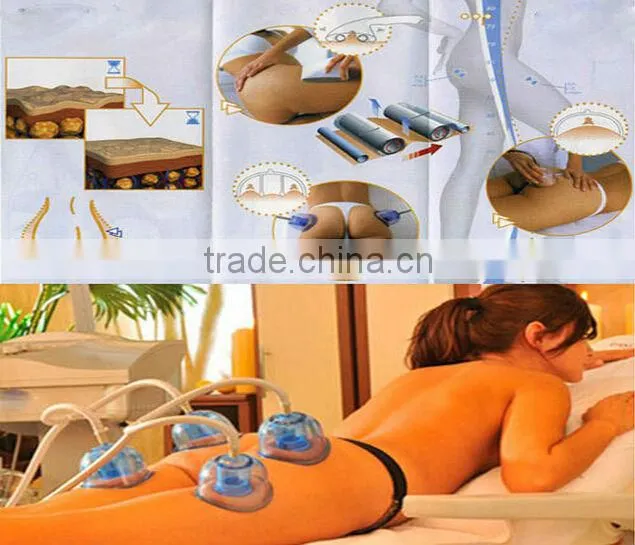4*double suction cup vacuum and cavitation slimming machine