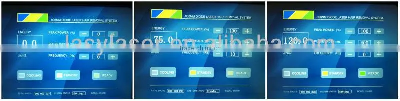 fast Diode laser hair removal