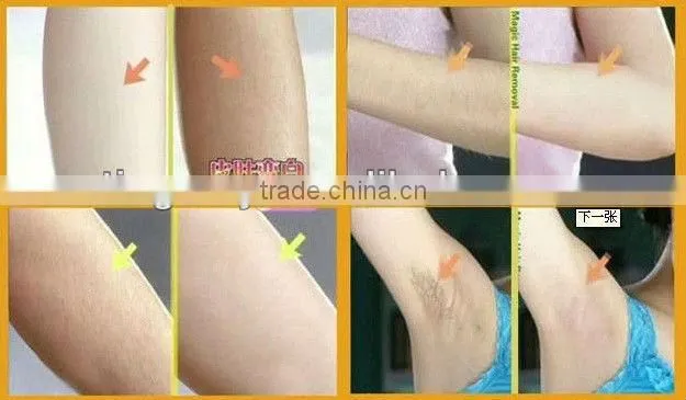 Professional ipl hair removal machine Button control