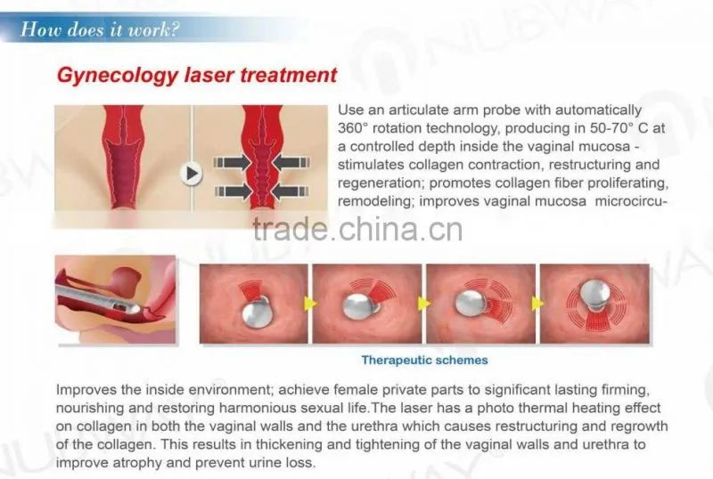 RF tube Fractional CO2 Laser Machine NBW-FII with vaginal handles