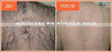 2016 Newest 2 handles OPT SHR IPL hair removal equipment/IPL SHR /3000W high power shr ipl machine