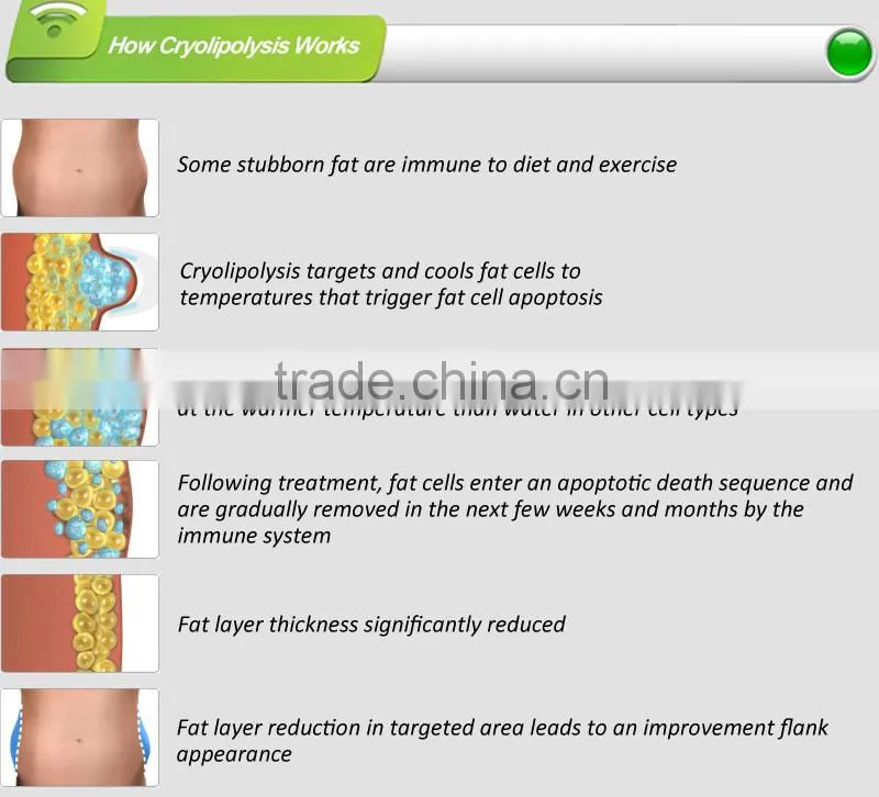 cryolipolysis slimming machine,10pcs medium anti-freeze membranes,Professional manufacturer in China&Fast and safe delivery