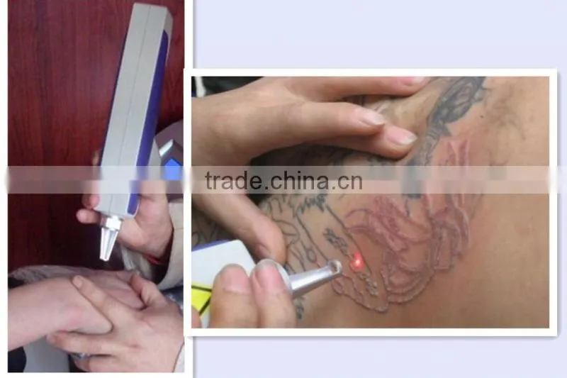 Q switch nd yag laser skin age spot removal machine