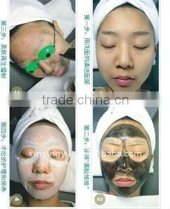 laser tattoo removal q switch nd yag laser