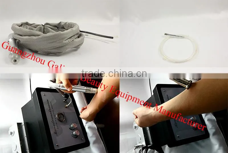 NEW!! home use diamond micro crystal dermabrasion microderm skin system