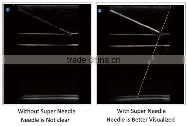 CE ISO approved medical 15 inch LCD Monitor 3D 4D trolley color doppler ultrasound scanner