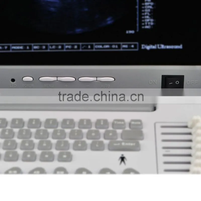 2016 Large Screen Cheapest Portable Ultrasounic Diagnosis Scanner Machine System with Convex/ Linear Transducer and Sony Printer