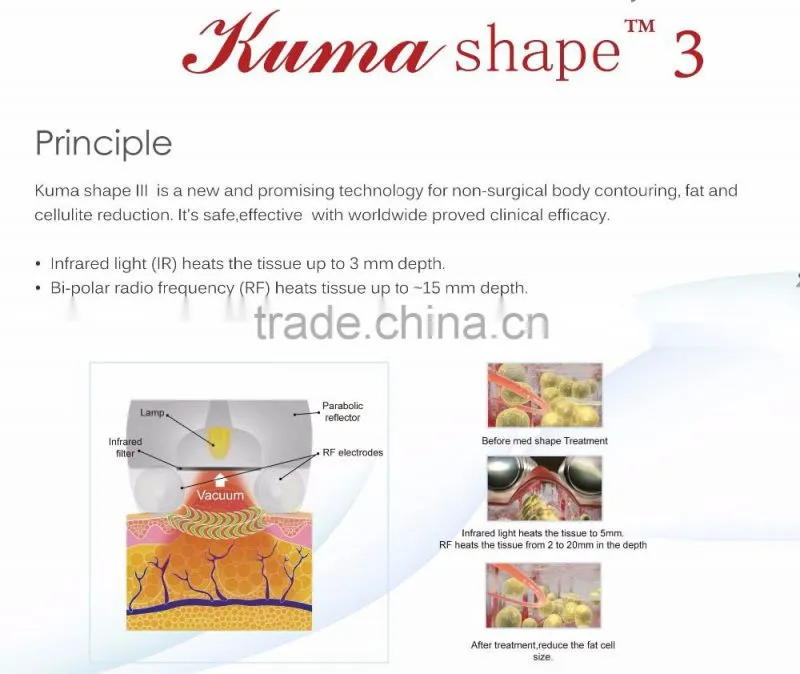 Vacuum body massager anti cellulite suction machine radiofrequency machine