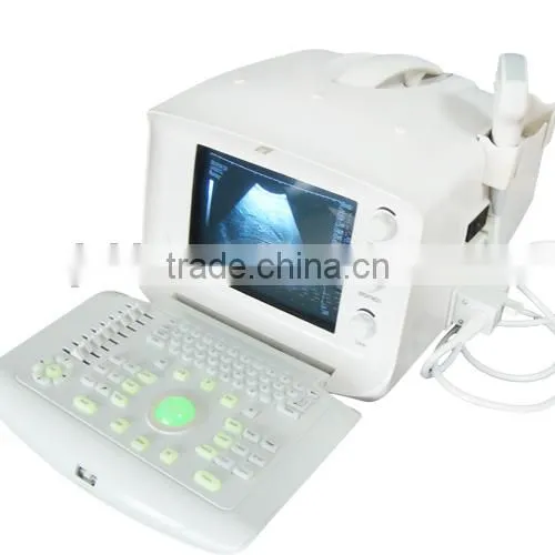 High performance ultrasound machine / ultrasound price / Full digital diagnostic ultrasound system