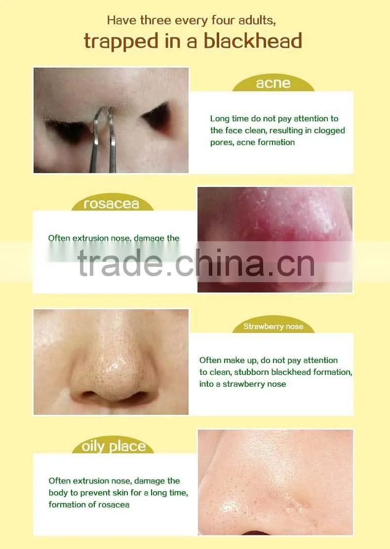 Best Selling Blackhead 24K Gold Peel-Off Mask For Acne and Spots