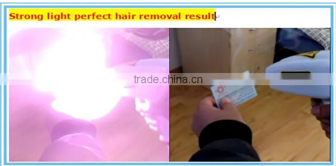 Permanent diode lazer hair removal machine