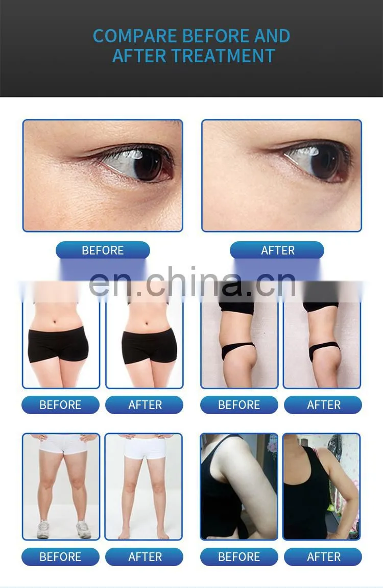 448Khz Factory rf cet ret Tecar Therapy Physiotherapy Machine Radio Frequency Diathermy Therapy Slimming Body Shaping Machine