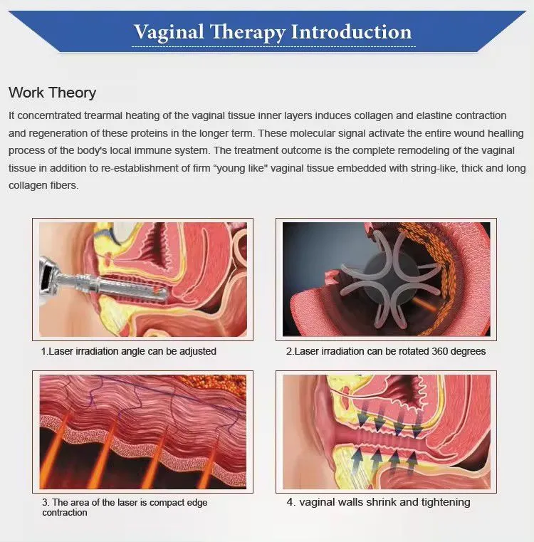 Ce Approved Fractional CO2 Laser Skin Resurfacing Machine CO2 Laser Vaginal Rejuvenation Machine Fractional Co2 Laser Price