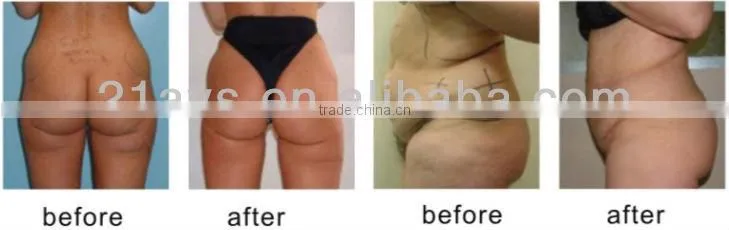2013 NEW Guangzhou new RF Laser cavitation & Vacumm multipolar fat-losing Slimming machine