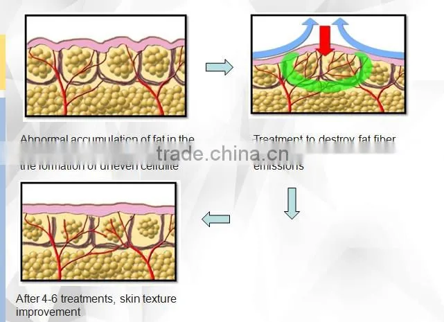 Alibaba salon equipment far infrared slimming suit for distrubutor