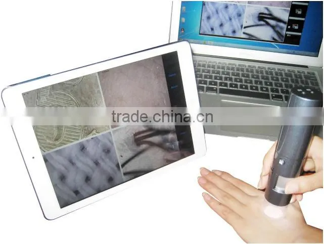 Portable WIFI facial and hair scanner analyzer diagnosis