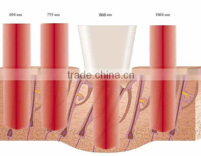 medical 808nm diode laser hair removal machine HS 811 laser hair removal device painless by shanghai apolo medical technology
