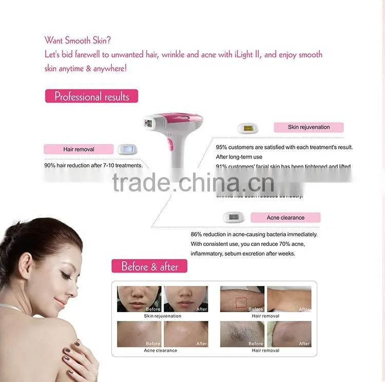 home IPL 3 functions beauty device for skin rejuveantion hair removal acne skin care