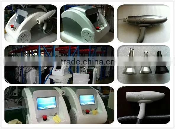 laser q-switch nd yag laser pigmentation removal machine for all pigment removal