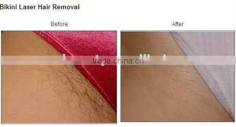 Constant Multi-pulse IPL Hair Removal &Skin Rejuvenation Beauty Machine-A005