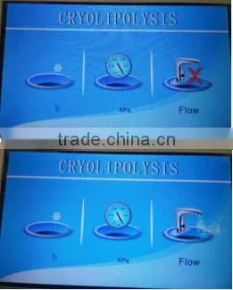Professional fat freezing lipolysis body cellulite remover machine